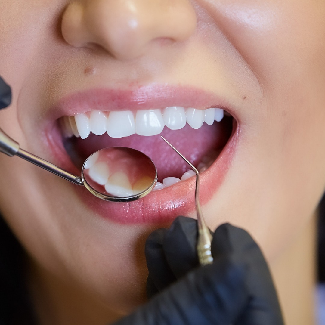 Paciente Sorrindo - Odonto Premium BH