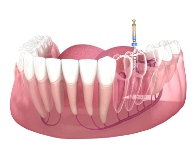 Endodontia